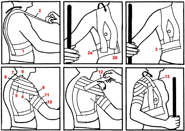Тейпирование лопатки и плеча при болях схема
